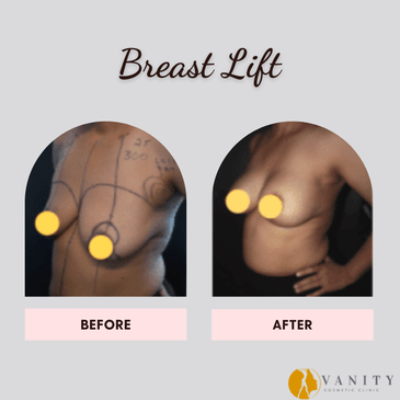 Slider image (7) Vanity Cosmetic Clinic